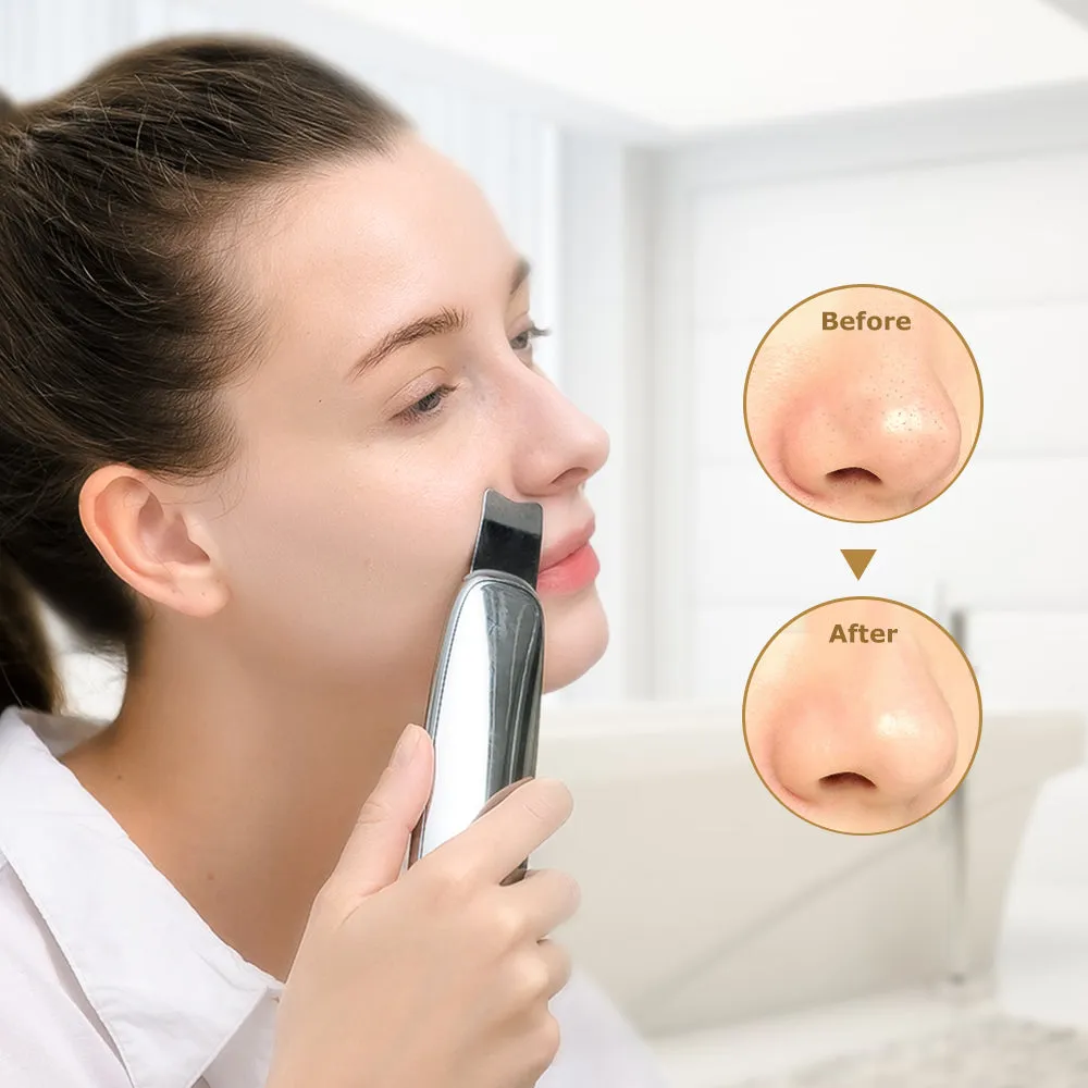 Deep Cleansing Ultrasonic Scrub Device, Ergonomic Design - TOUCHBeauty